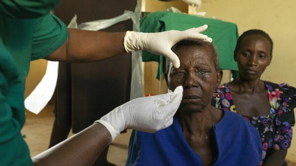 Trichiasis patient Edisa Nalubanga has her bandages removed after surgery.
