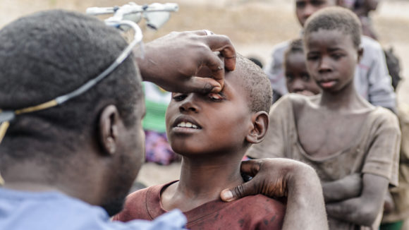 Eye surgeon Dr Ndalela examines a child's eyes to check for signs of trachoma.