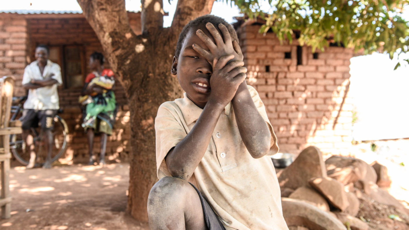 Taonga holds his hand to his eye to shield it, while looking in pain.