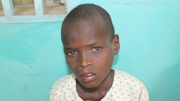 Young boy waiting trichiasis surgery in Cameroon.