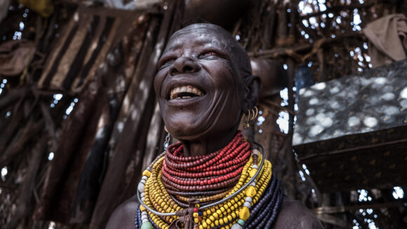 A woman wearing many colourful necklaces smiles after having bandages removed.