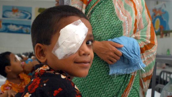 Young boy with bandage over one eye.