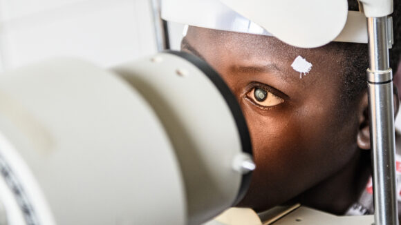 A young boy has his eyes checked for cataracts using an optical machine.