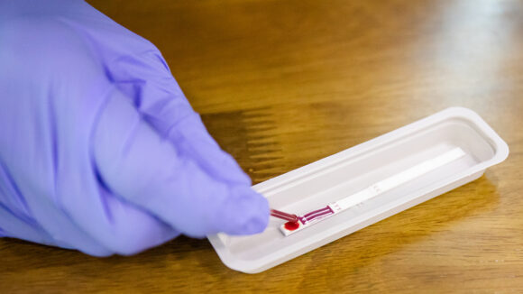 A close-up of a gloved hand testing a blood sample.