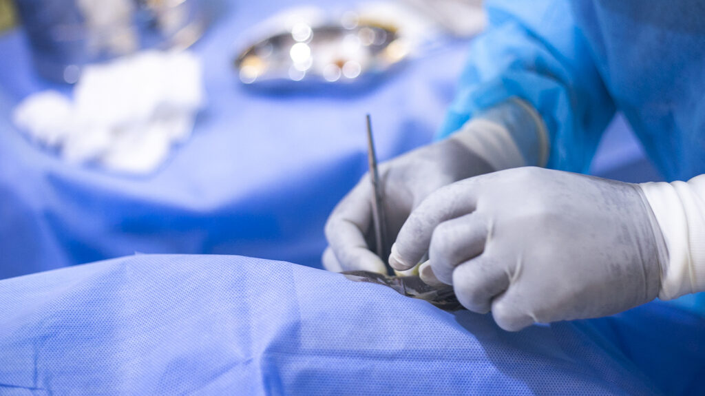 A close-up of a surgeon's hands as they perform eye surgery.