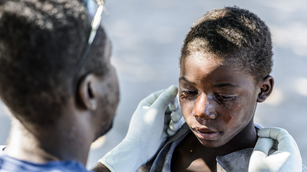 Nananga has his eyes examined.