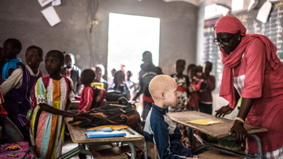 A teacher gives guidance to a young boy with albinism in a classroom in Senegal.