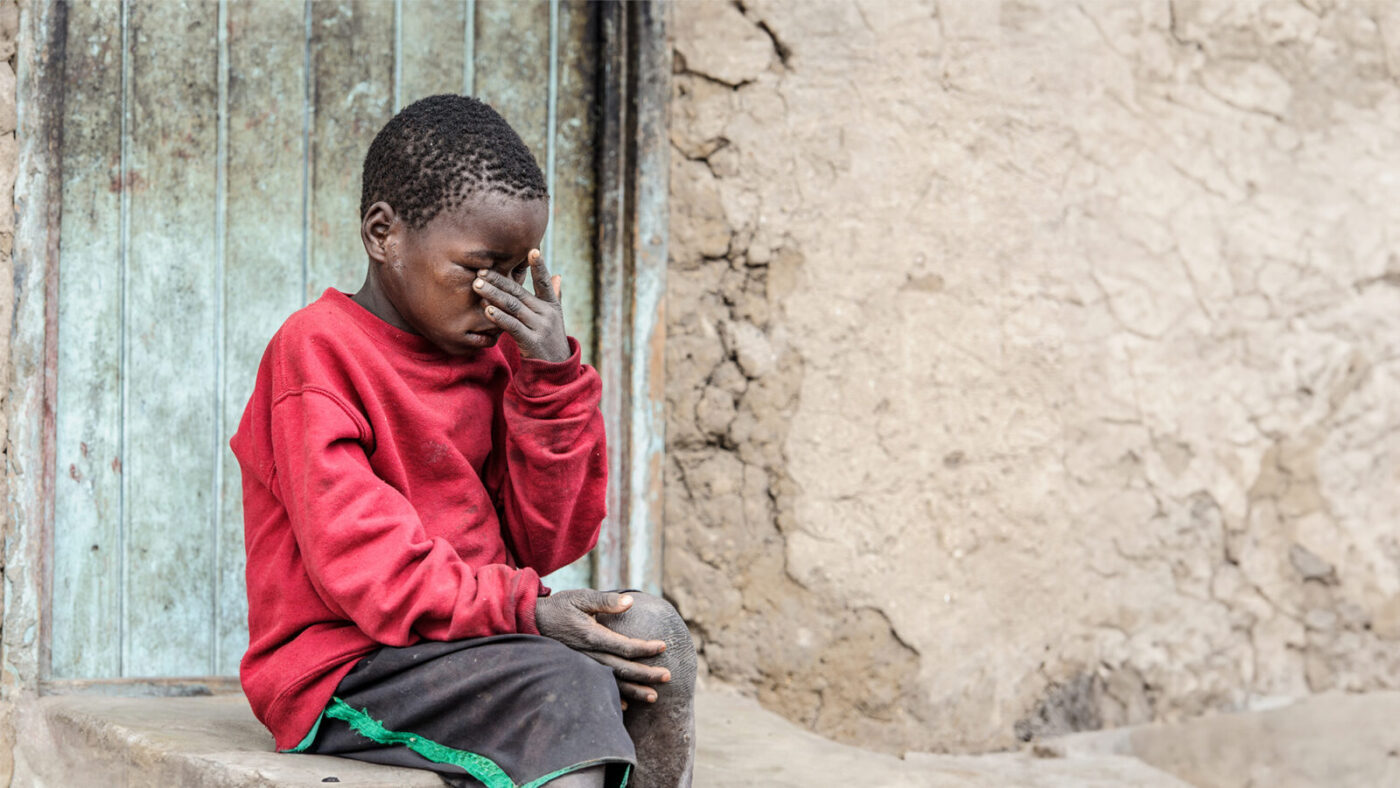Mwiza, an eight-year-old boy with trachoma, shields his eyes from the sun as he sits on a step outside his home.