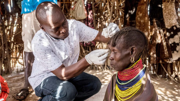 Eye Surgeon Edwin Simiyu checks Ipo Nabur's eye the day after her trachoma operation in her home, in Turkana, Kenya