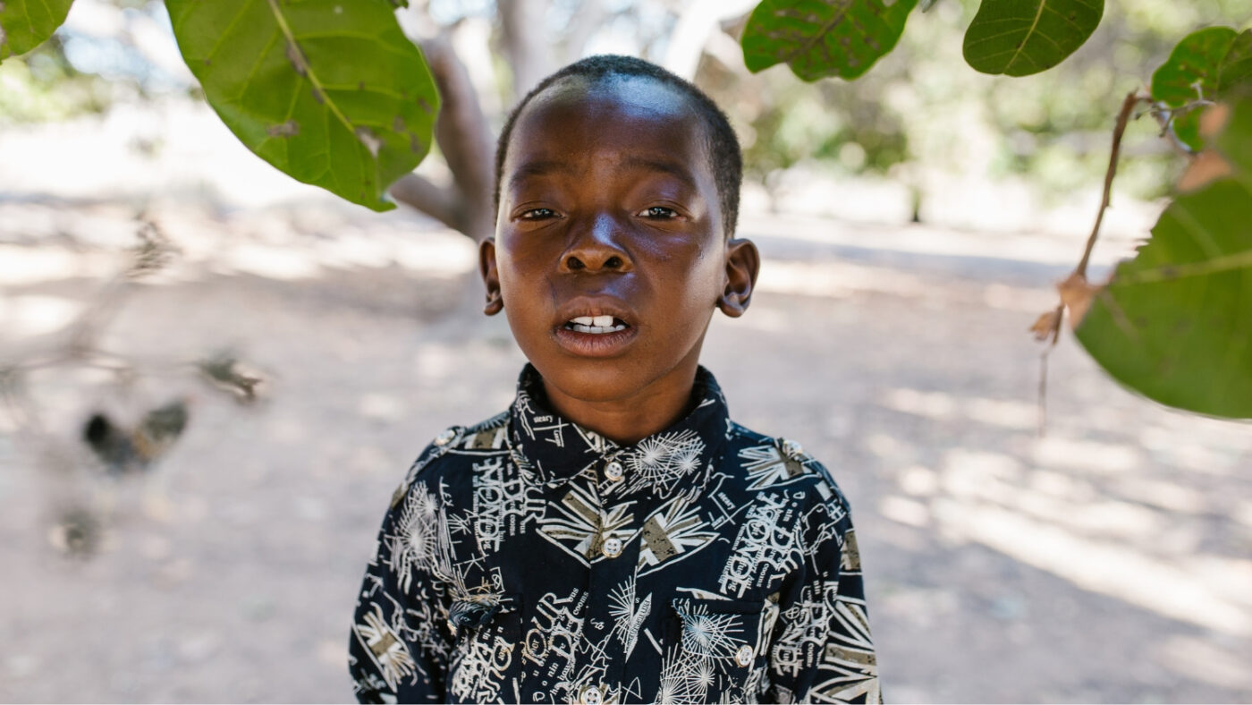 Mohamed stands outside alone under a tree. He struggles to keep his eyes open due to the pain of trachoma.