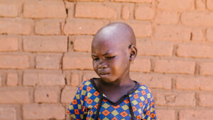 A young girl, Mwamini, stands outside in Tanzania, squinting in pain. Her eyes are weeping.